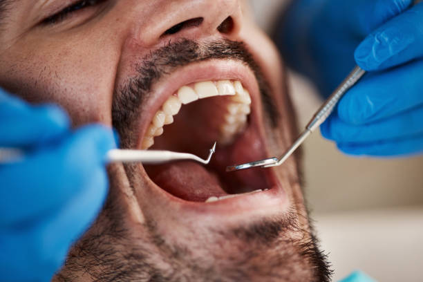 Best Emergency Denture Repair in Mmerce City, CO